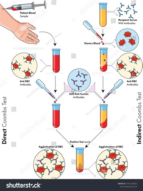 coombs test blood bottle|what is coombs blood test.